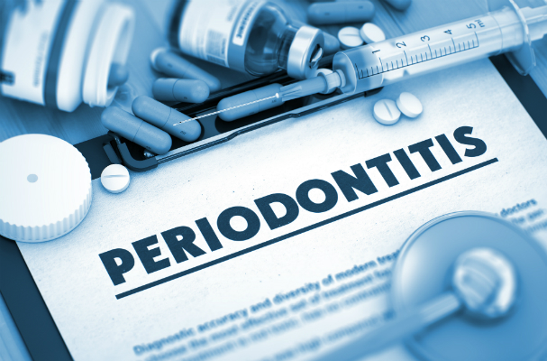 Periodontitis hurts you physically