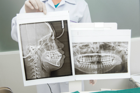 oral x-ray